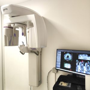 CBCT ConeBeam MyRay