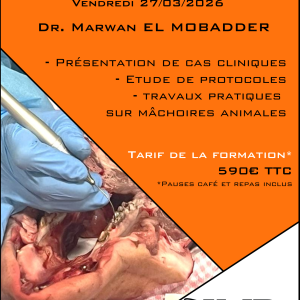 Laser et parodontologie implantologie prothèse